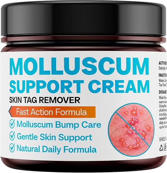 Molluscum Support Treatment